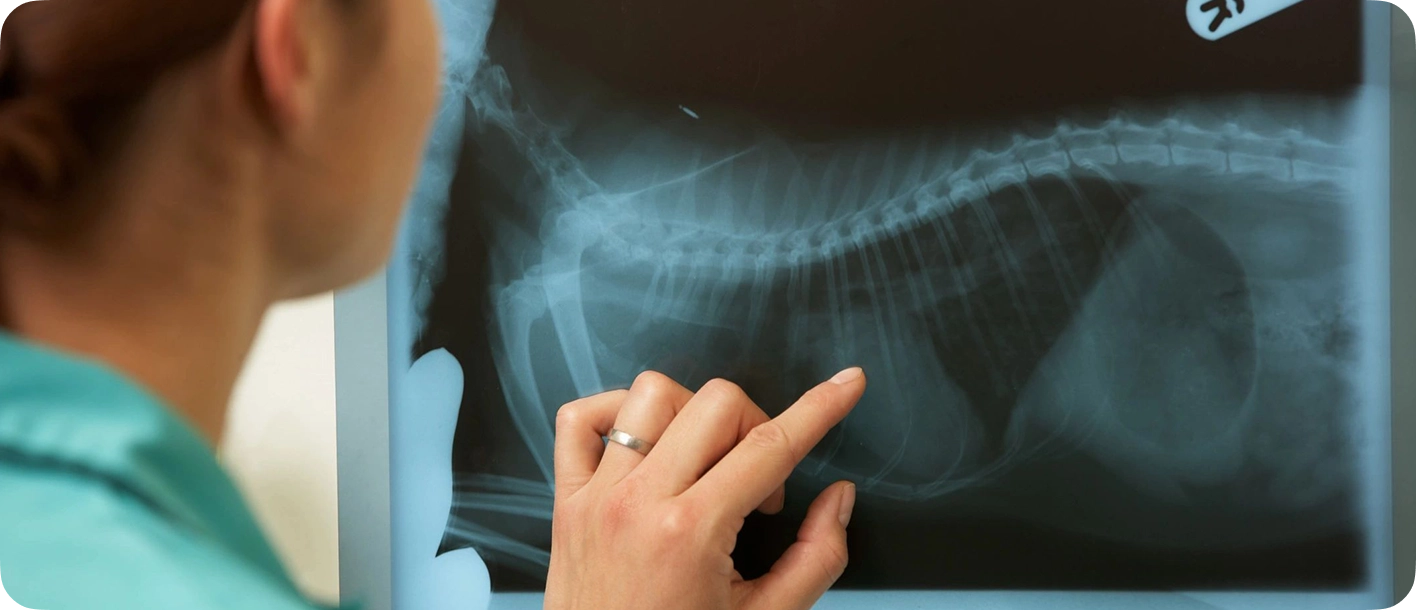 A person touching an x-ray image of their shoulder.