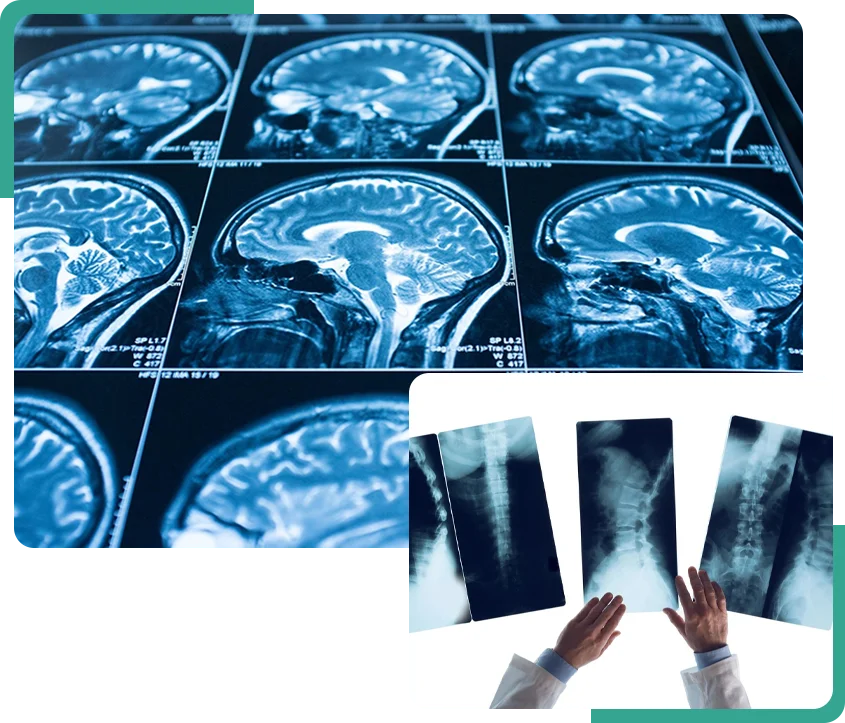 A person holding up x-rays in front of them.